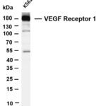 VEGF Receptor 1 Rabbit Monoclonal Antibody