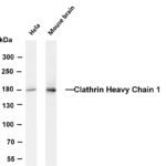 Clathrin Heavy Chain 1 Rabbit Monoclonal Antibody