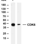 CDK6 Rabbit Monoclonal Antibody