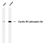 Cyclin B1 (Phospho-Ser126) Rabbit Monoclonal Antibody