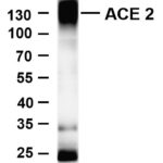ACE2 Rabbit Monoclonal Antibody