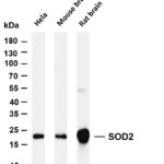 SOD2 Rabbit Monoclonal Antibody