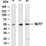 MiTF Rabbit Monoclonal Antibody