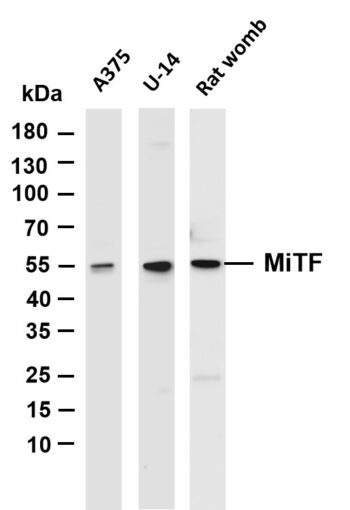 MiTF Rabbit Monoclonal Antibody