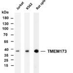 TMEM173 Rabbit Monoclonal Antibody
