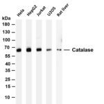 Catalase Rabbit Monoclonal Antibody