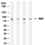 RIP Rabbit Monoclonal Antibody
