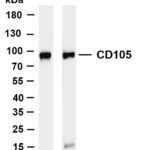 CD105 Rabbit Monoclonal Antibody