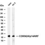 CDKN2A/p14ARF Rabbit Monoclonal Antibody