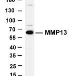 MMP13 Rabbit Monoclonal Antibody