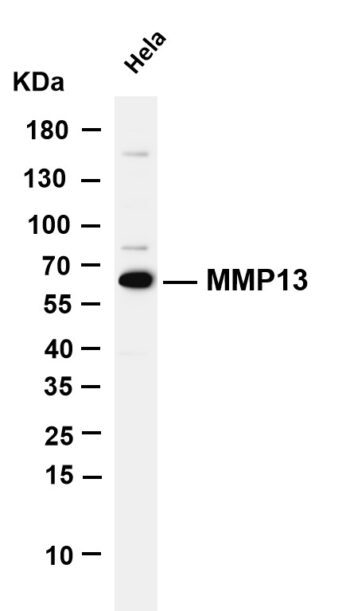 MMP13 Rabbit Monoclonal Antibody