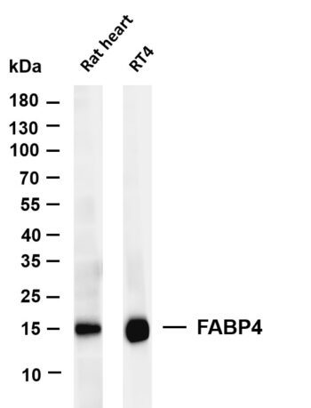 FABP4 Rabbit Monoclonal Antibody