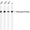 Polycomb Protein SUZ12 Rabbit Monoclonal Antibody