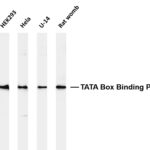 TATA Box Binding Protein Rabbit Monoclonal Antibody