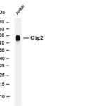 Ctip2 Rabbit Monoclonal Antibody
