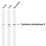 Carbonic Anhydrase 9 Rabbit Monoclonal Antibody