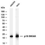 p16 INK4A Rabbit Monoclonal Antibody