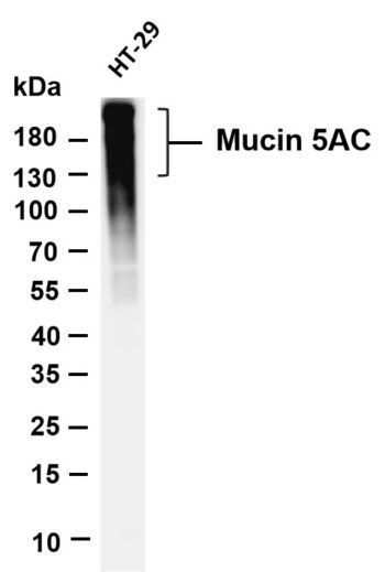 Mucin 5AC Rabbit Monoclonal Antibody
