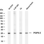 PGP9.5 Rabbit Monoclonal Antibody