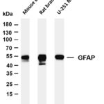 GFAP Rabbit Monoclonal Antibody