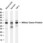 Wilms Tumor Protein Rabbit Monoclonal Antibody
