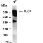 Ki67 Rabbit Monoclonal Antibody
