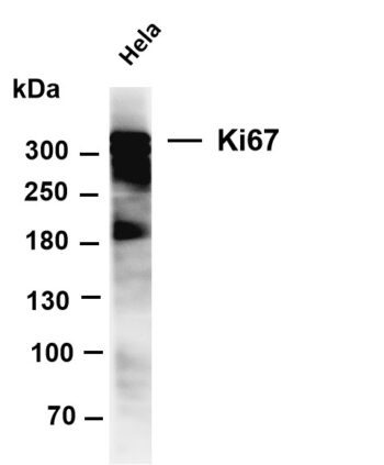 Ki67 Rabbit Monoclonal Antibody