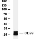 CD99 Rabbit Monoclonal Antibody