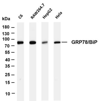GRP78/BiP Rabbit Monoclonal Antibody