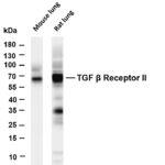 TGF β Receptor II Rabbit Monoclonal Antibody