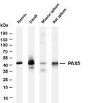 PAX5 Rabbit Monoclonal Antibody
