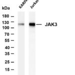 JAK3 Rabbit Monoclonal Antibody