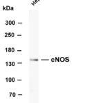 eNOS Rabbit Monoclonal Antibody