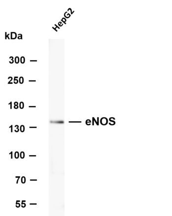 eNOS Rabbit Monoclonal Antibody