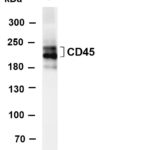 CD45 Rabbit Monoclonal Antibody