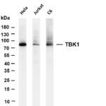 TBK1 Rabbit Monoclonal Antibody