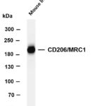 CD206/MRC1 Rabbit Monoclonal Antibody