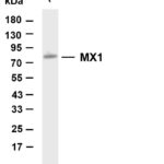 MX1 Rabbit Monoclonal Antibody