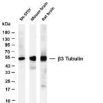 β3 Tubulin Rabbit Monoclonal Antibody