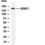 ASK1 Rabbit Monoclonal Antibody