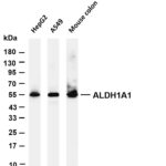 ALDH1A1 Rabbit Monoclonal Antibody