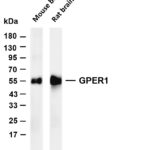 GPER1 Rabbit Monoclonal Antibody