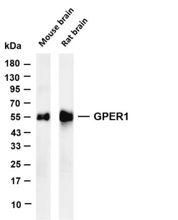 GPER1 Rabbit Monoclonal Antibody
