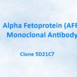Alpha Fetoprotein (AFP) Monoclonal Antibody, 5D21C7