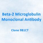 Beta-2 Microglobulin Monoclonal Antibody, 9B1C7