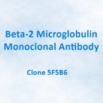 Beta-2 Microglobulin Monoclonal Antibody, 5F5B6