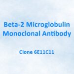 Beta-2 Microglobulin Monoclonal Antibody, 6E11C11