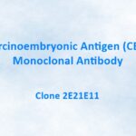 Carcinoembryonic Antigen (CEA) Monoclonal Antibody, 2E21E11