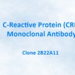 C-Reactive Protein/CRP Monoclonal Antibody, 2B22A11