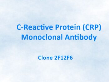 C-Reactive Protein/CRP Monoclonal Antibody, 2F12F6